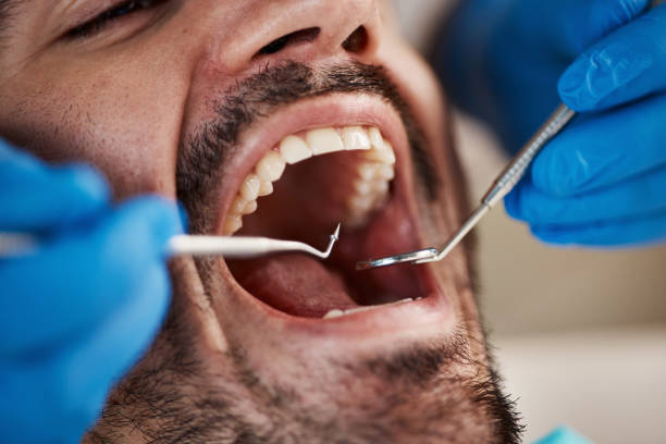 Best Emergency Dental Care for Broken or Chipped Teeth in Licking, MO
