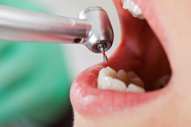 Best Weekend Emergency Dentist in Licking, MO